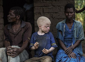 Caccia agli albini in Malawi alla vigilia del voto