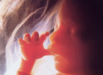 Quanti soldi per l’aborto, l’Oms tratta i nascituri come una malattia