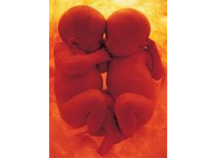 gemelli gemelli
