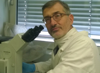 Indagine sulla spike, la proteina "killer" che causa le reazioni avverse