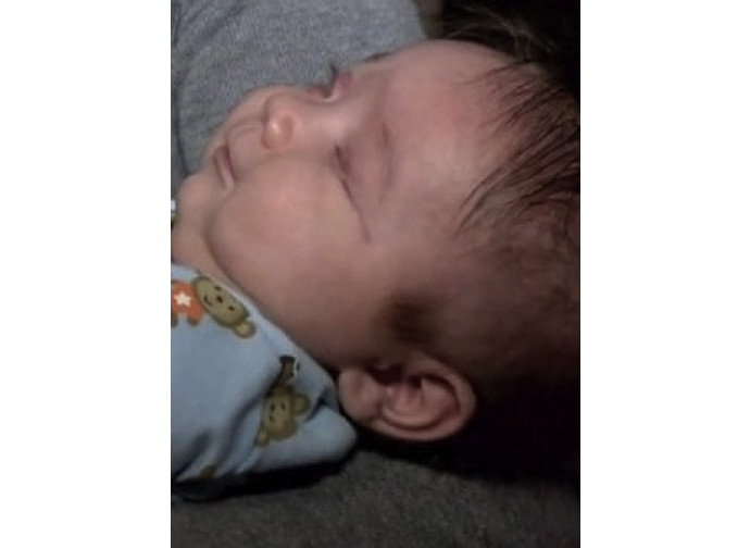 Richie, il bimbo nato senza gli occhi Richie, il bimbo nato senza gli occhi